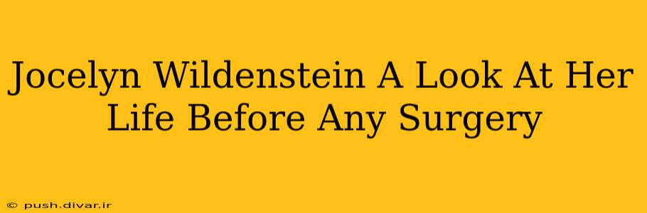 Jocelyn Wildenstein A Look At Her Life Before Any Surgery