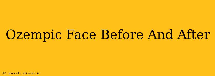 Ozempic Face Before And After