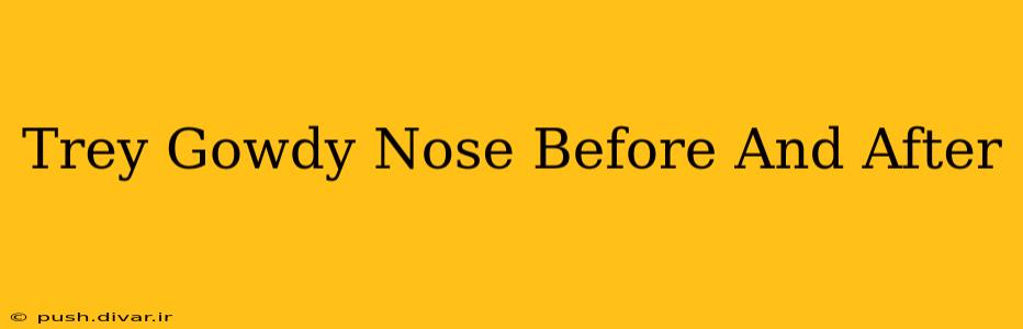 Trey Gowdy Nose Before And After