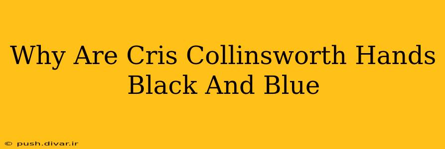 Why Are Cris Collinsworth Hands Black And Blue